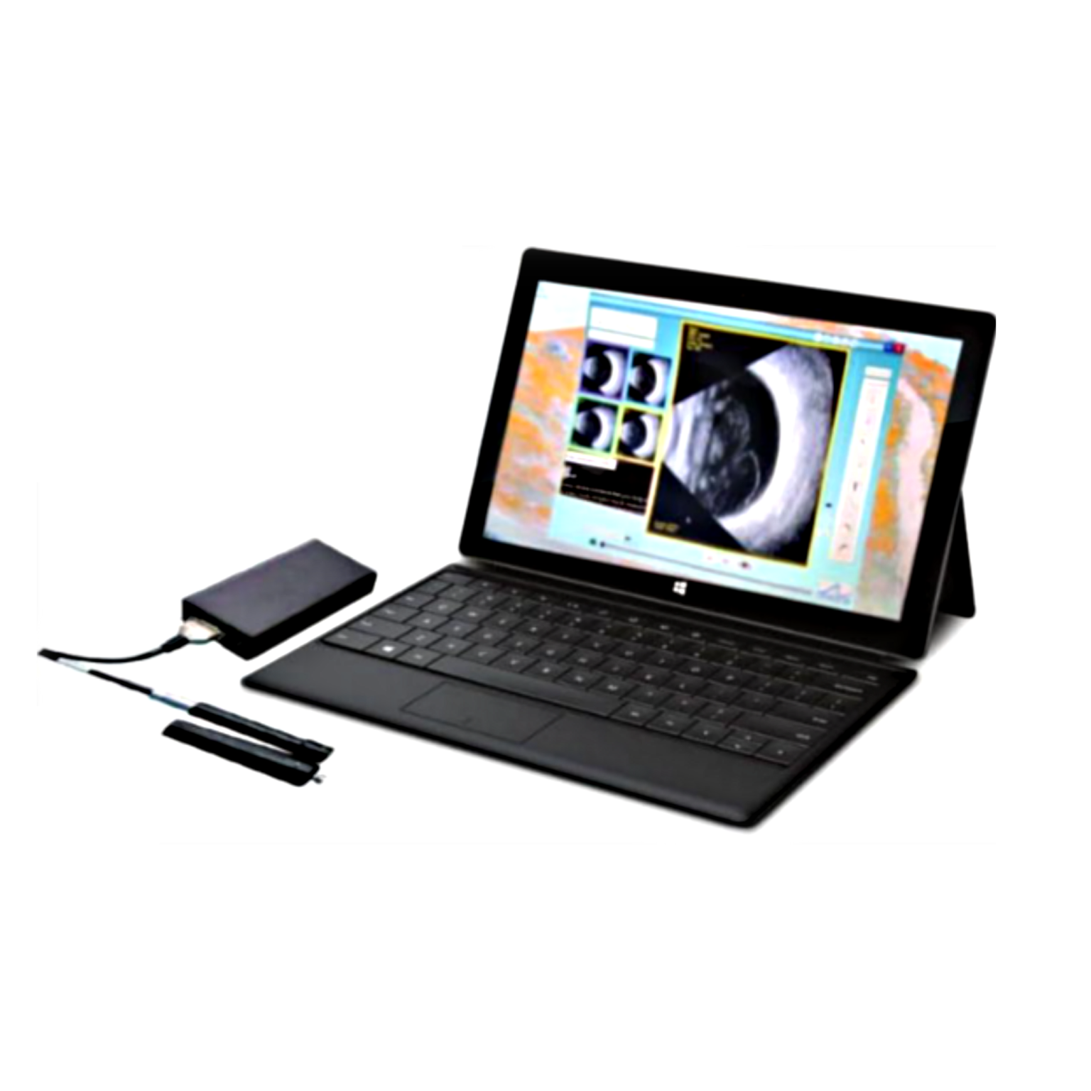 SPS Vitrectomy Cutter anvision